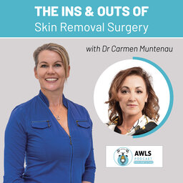 The ins and outs of Skin Removal Surgery - Dr Carmen Muntenau