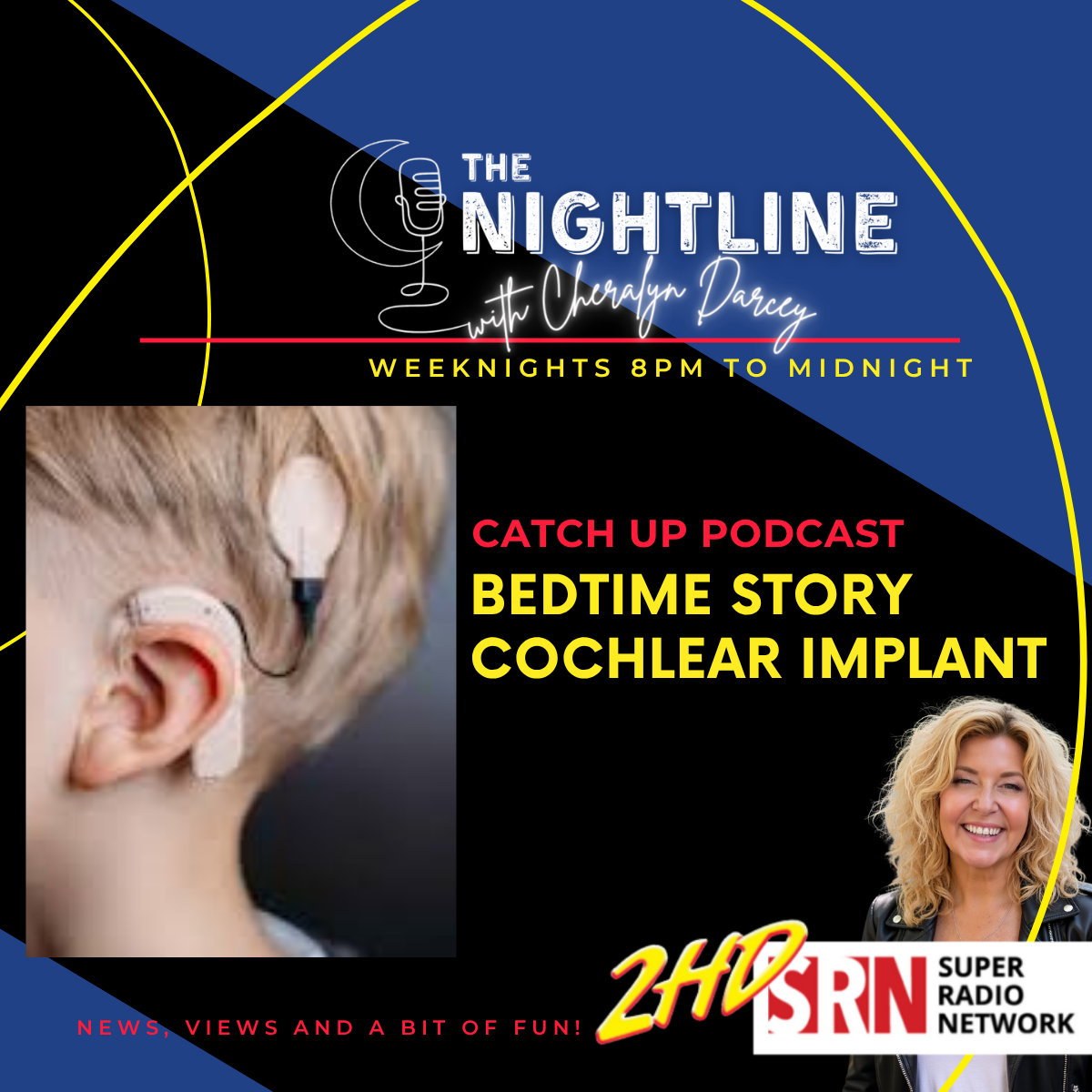 BEDTIME STORY: Cochlear Implant 16 June 2026 episode artwork