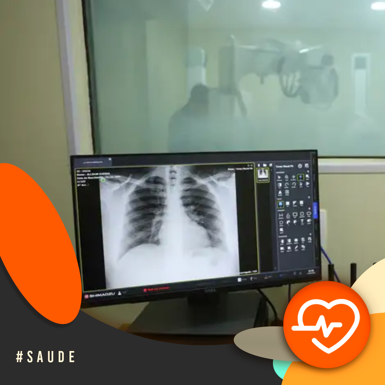 Com a Saúde em Dia - Síndrome Respiratória Grave: sinais de alerta e prevenção