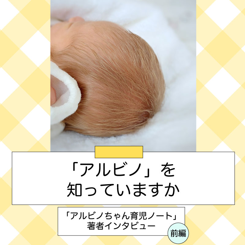 「アルビノ」を知っていますか～「アルビノちゃん育児ノート」著者インタビュー（前編）