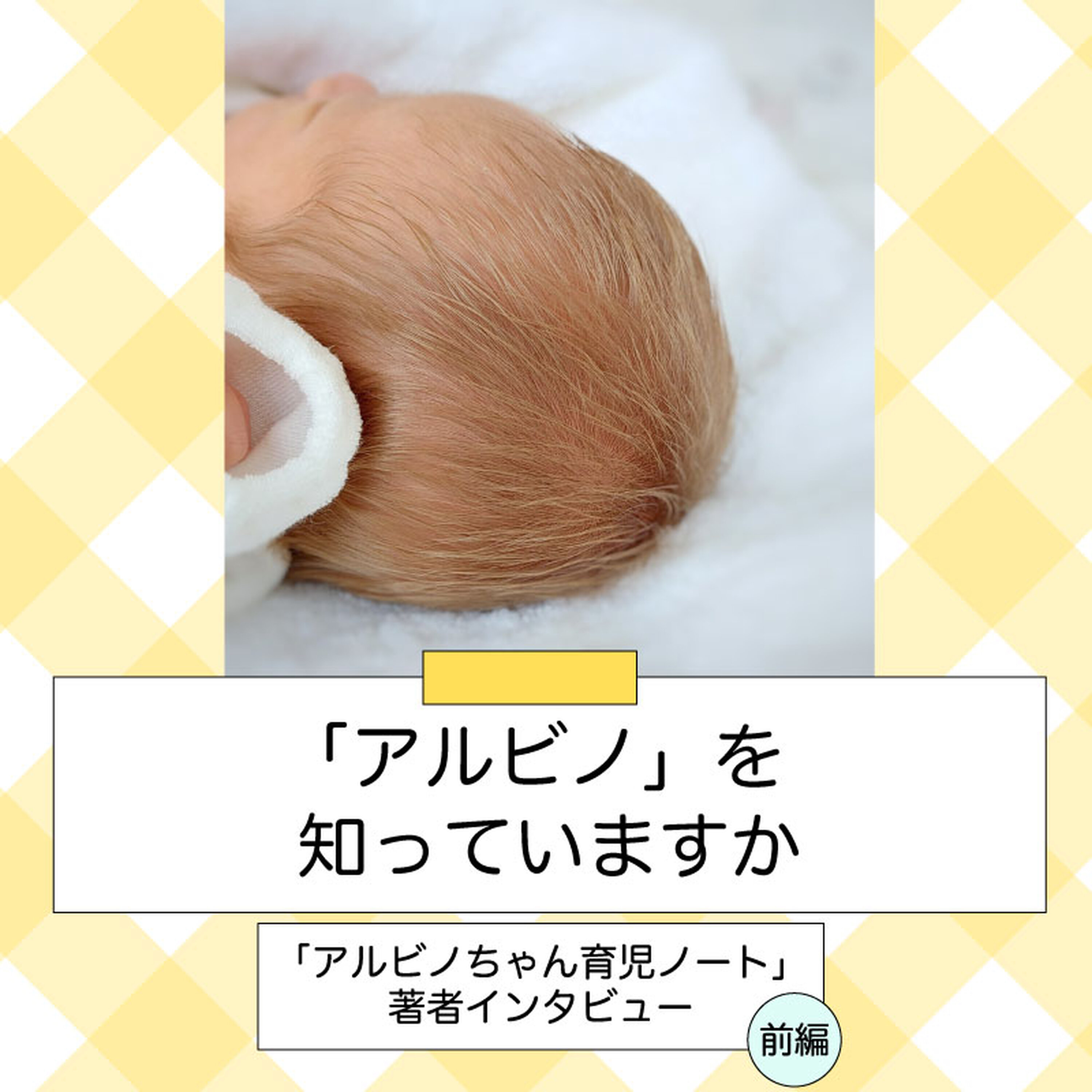 「アルビノ」を知っていますか~「アルビノちゃん育児ノート」著者インタビュー(前編)