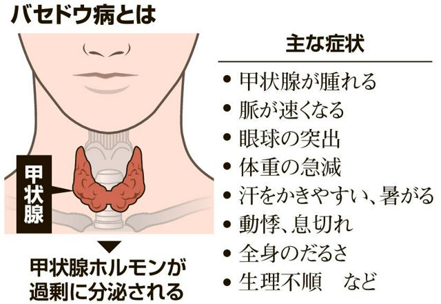 1月4日 12時のAI編集長ピックアップニュース