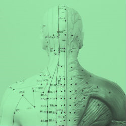 דיקור גם בג'ים