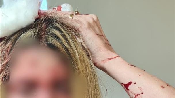 "הוא אמר 'נתתי לה את המכות האלה בגלל שריחמתי עליה'"