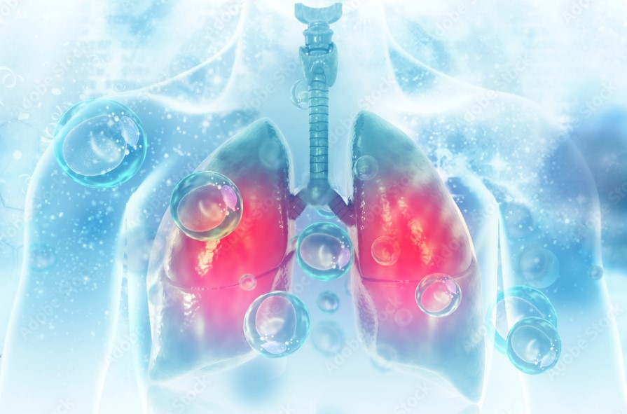 Ep. 17 - Benefici di BioFire Pneumonia plus in AMS, con parte specifica in merito a Pronto Soccorso