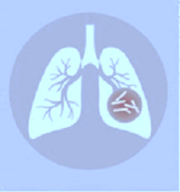 Ep. 16 - Nuove tecnologie diagnostiche per l’identificazione rapida e accurata della tubercolosi