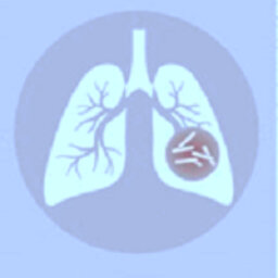 Ep. 16 - Nuove tecnologie diagnostiche per l’identificazione rapida e accurata della tubercolosi