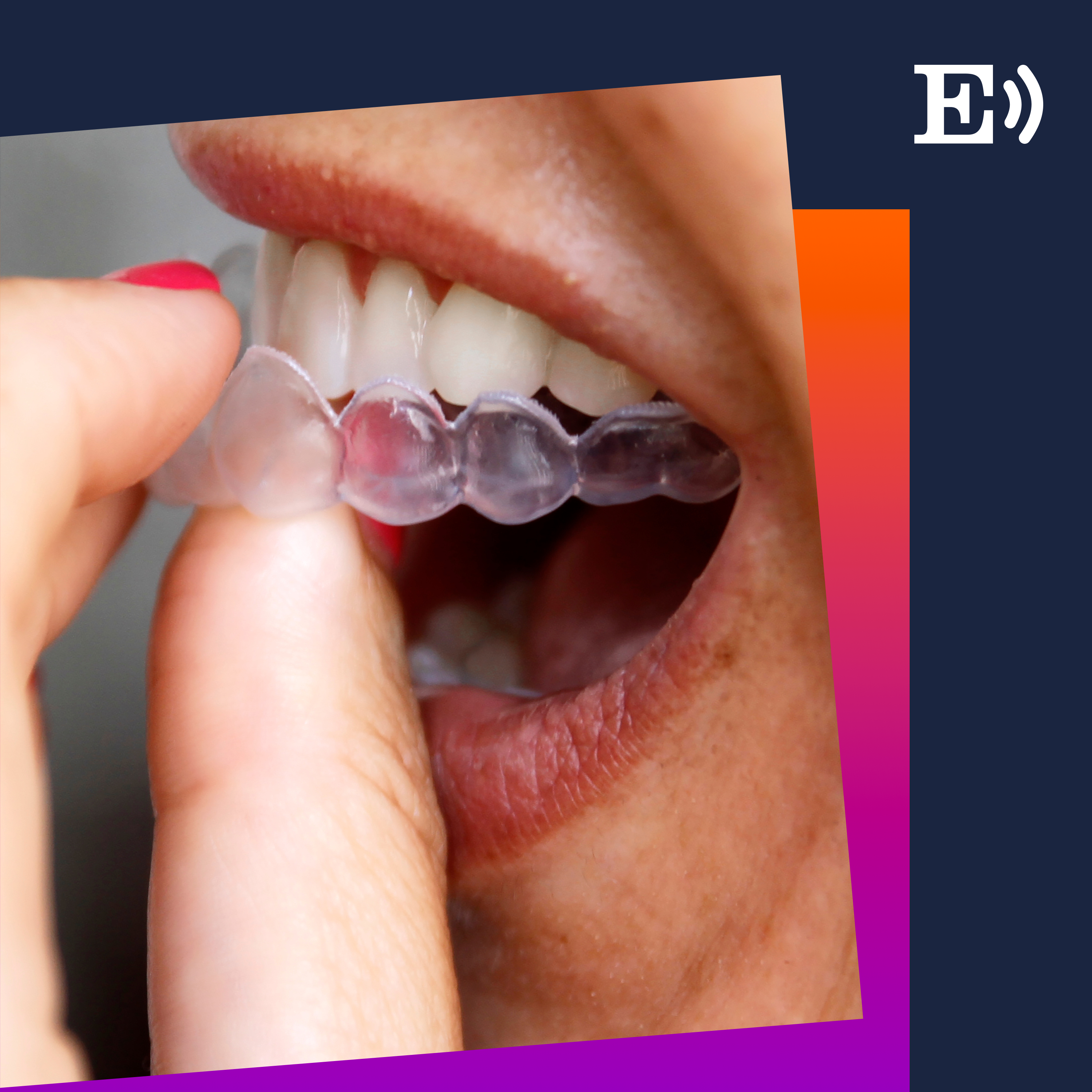 Imagen de Por salud o por estética: ¿tú también llevas ortodoncia invisible?