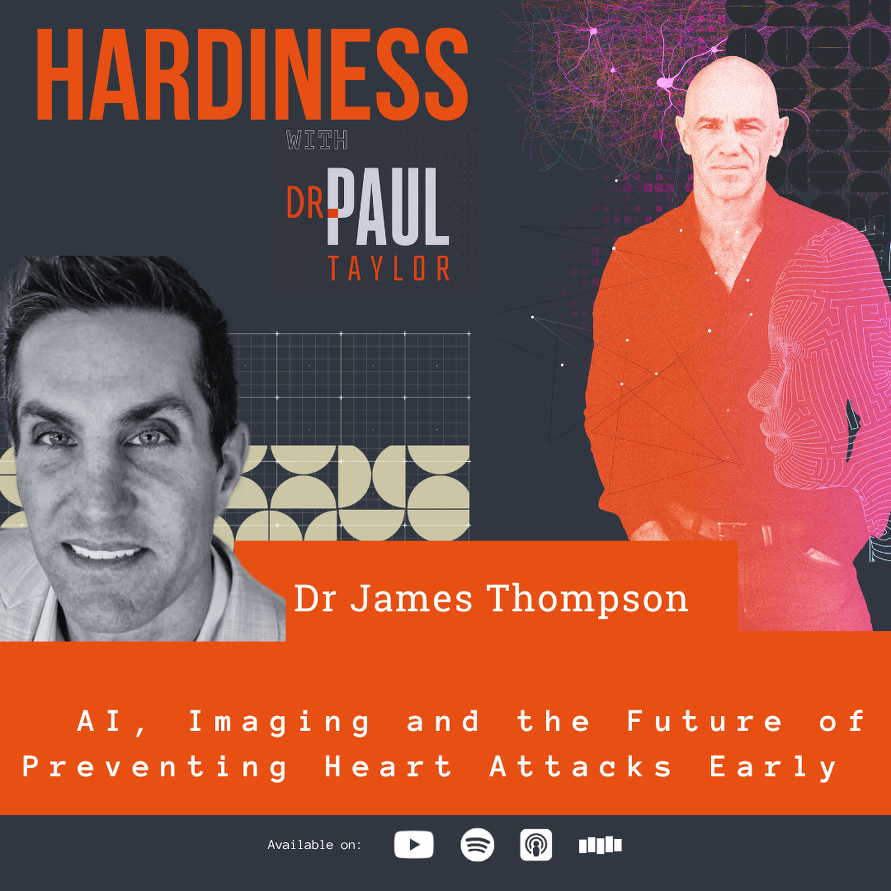 AI, Imaging, and the Future of Preventing Heart Attacks Early with Dr James Thompson