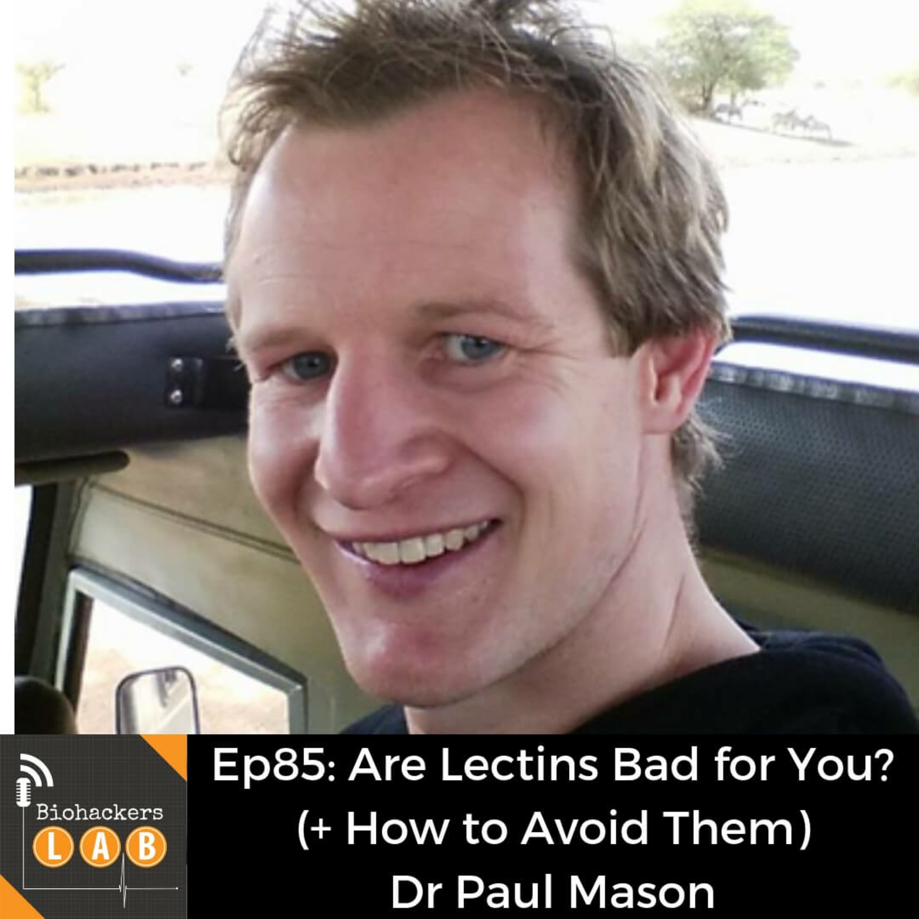 Are Lectins Bad for You? (+ How to Avoid Them) • Dr Paul Mason Are Lectins Bad for You? (+ How to Avoid Them) • Dr Paul Mason