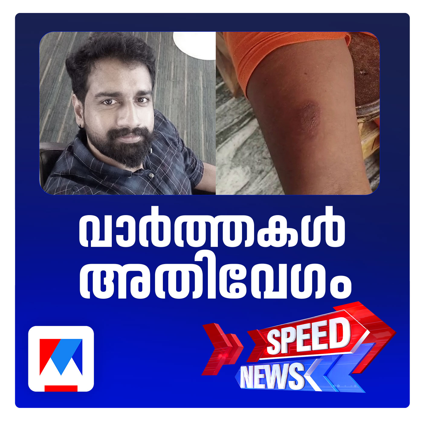സൂര്യാഘാതമേറ്റ് ഒരു മരണം; സ്പീഡ് ന്യൂസ്
