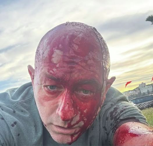 Antisemitism in Australia