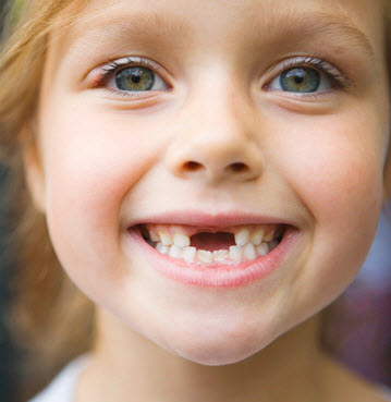 What happens when the tooth fairy loses a tooth?