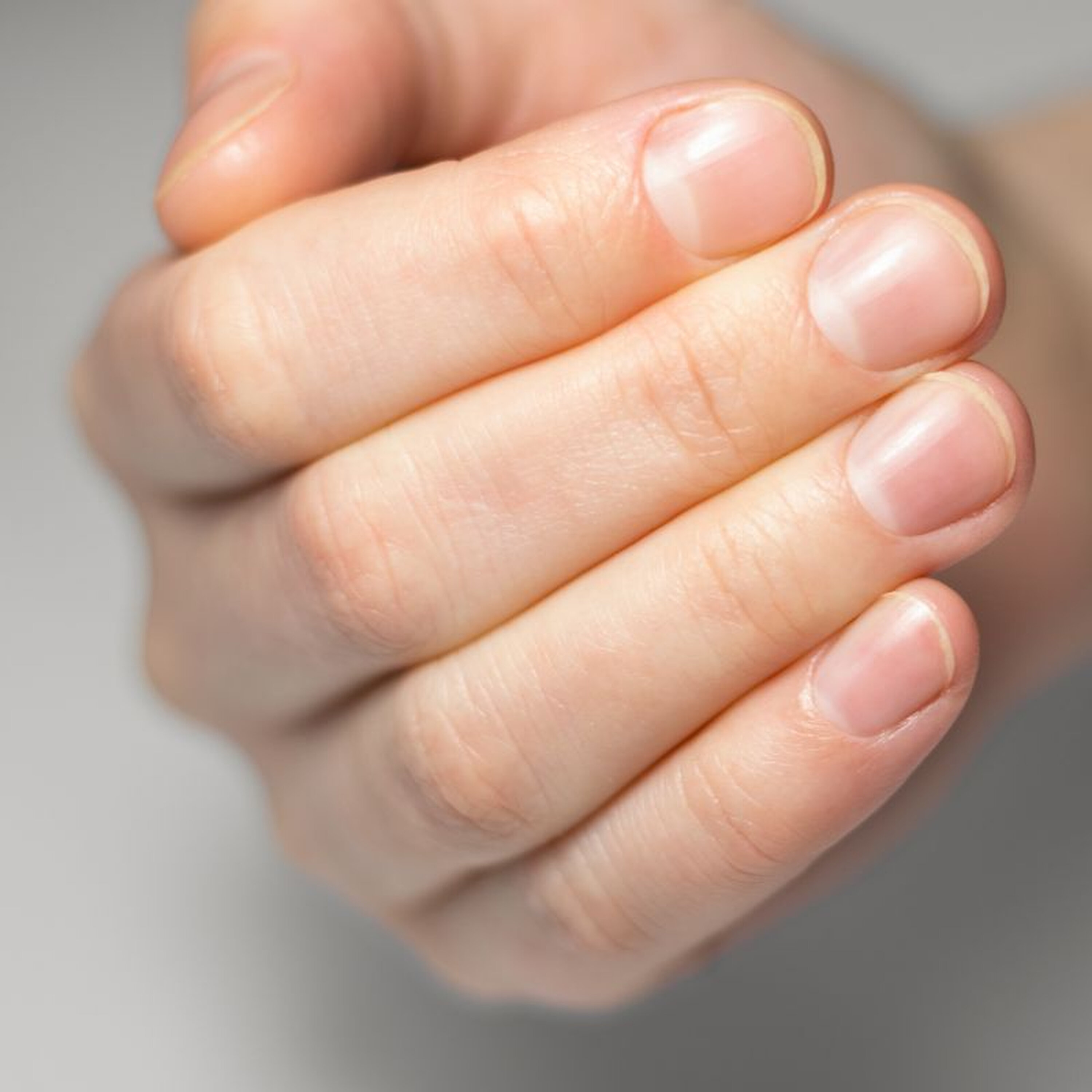 Bare Nails are back, but Ballzer was ahead of the trend episode artwork