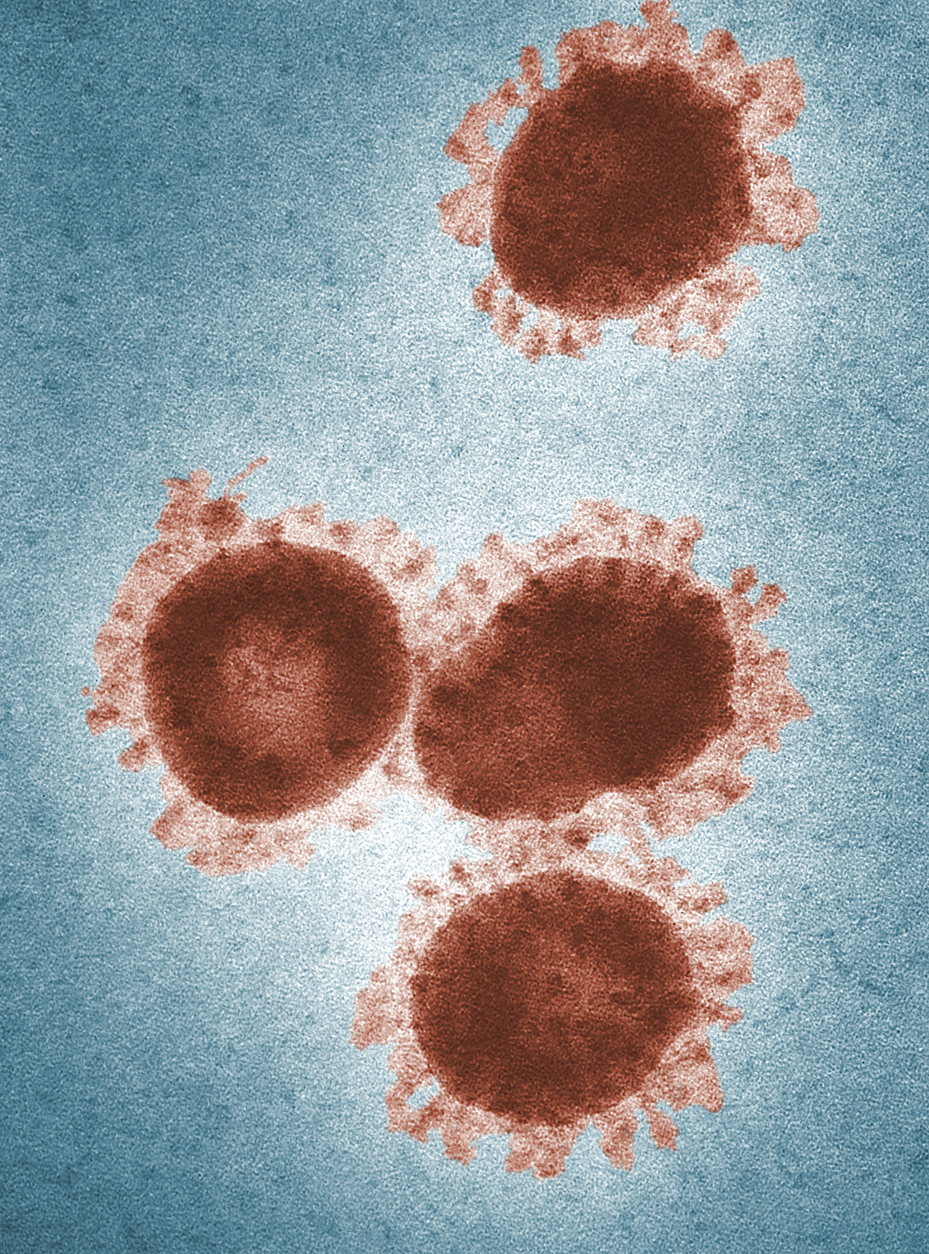 How does Monkeypox spread… and how is it stigmatizing the gay community?