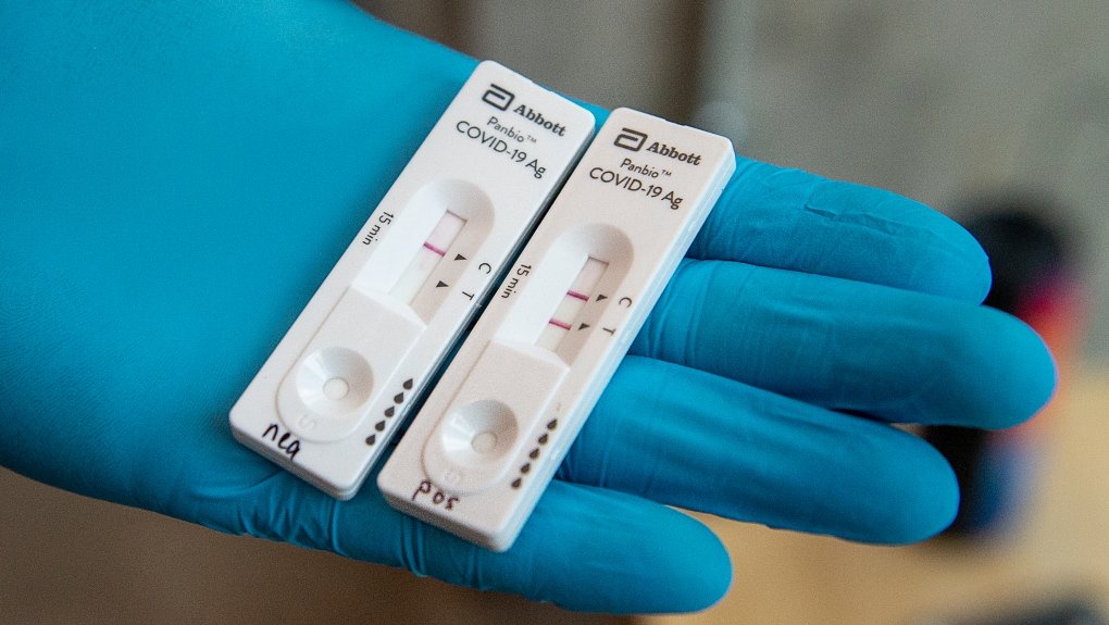 Why some people test positive for COVID months after infection