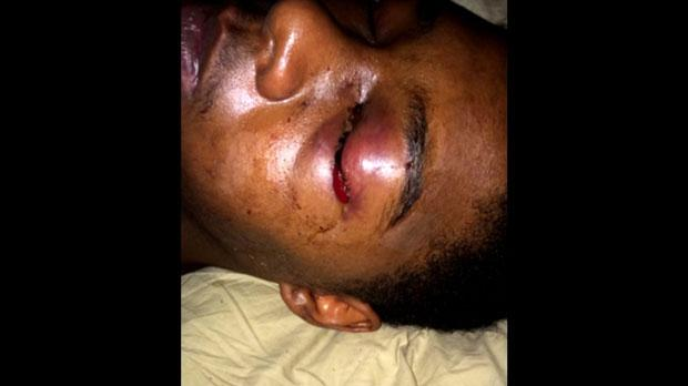 Testimony of Dafonte Miller