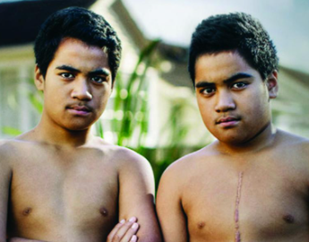 Rheumatic Fever - Dr Natasha Bansal – General Practitioner at The Fono Manurewa