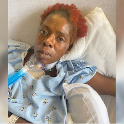 Police trying to identify woman placed in 3-week coma after being hit by car in Lawncrest