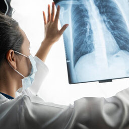 Health experts say more lung cancer screenings could save lives