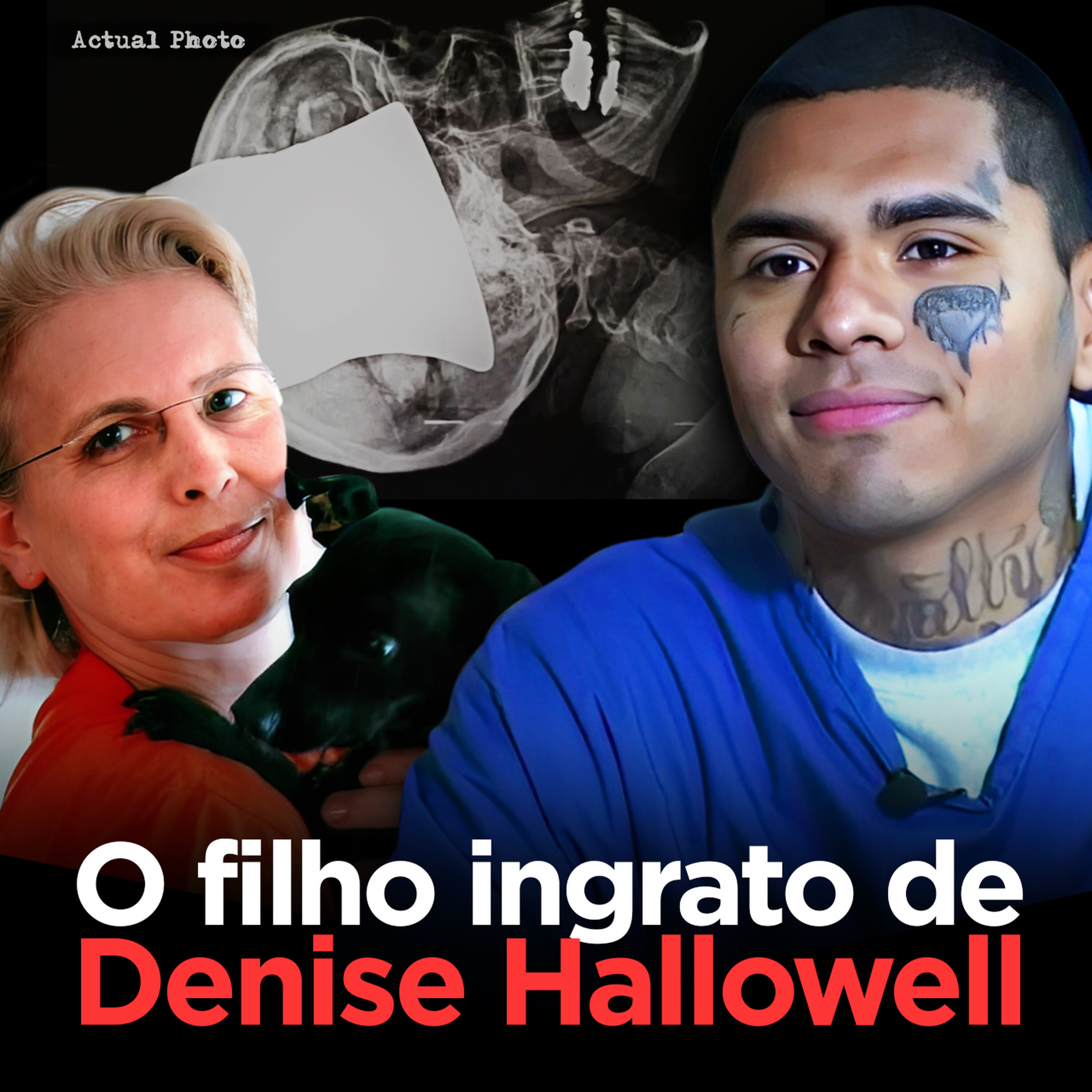 Enfiou um Machado na cabeça da própria mãe | Carlos e Denise Hallowell
