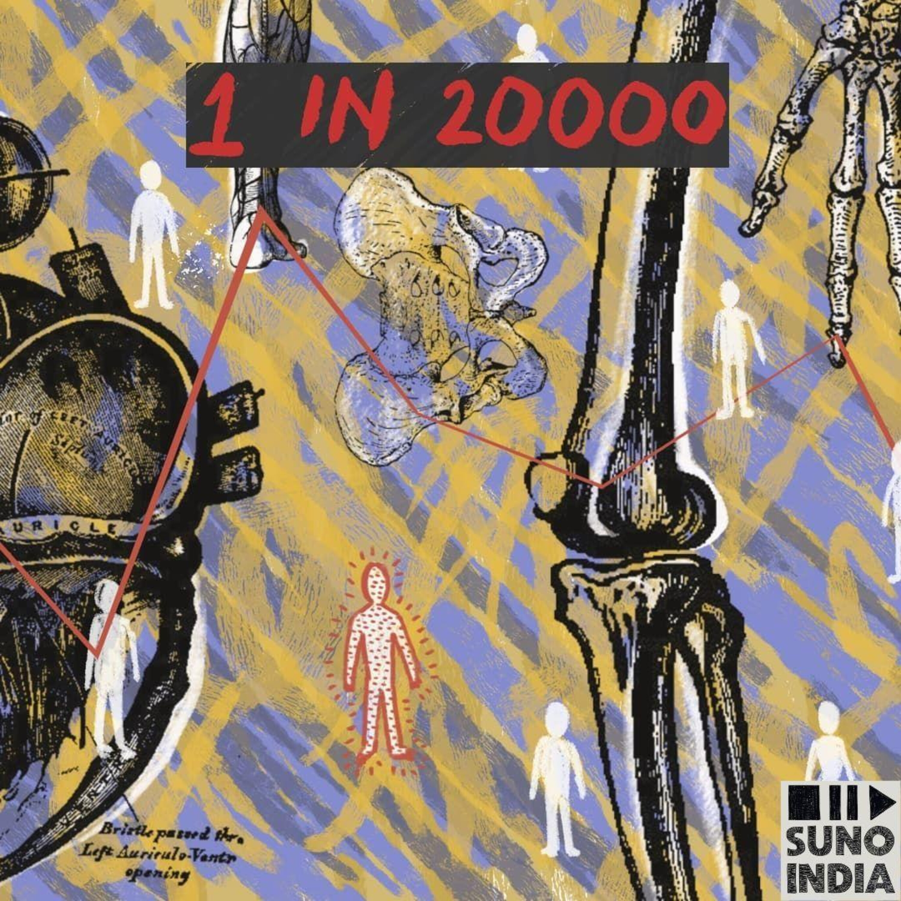 Introducing 1 in 20000