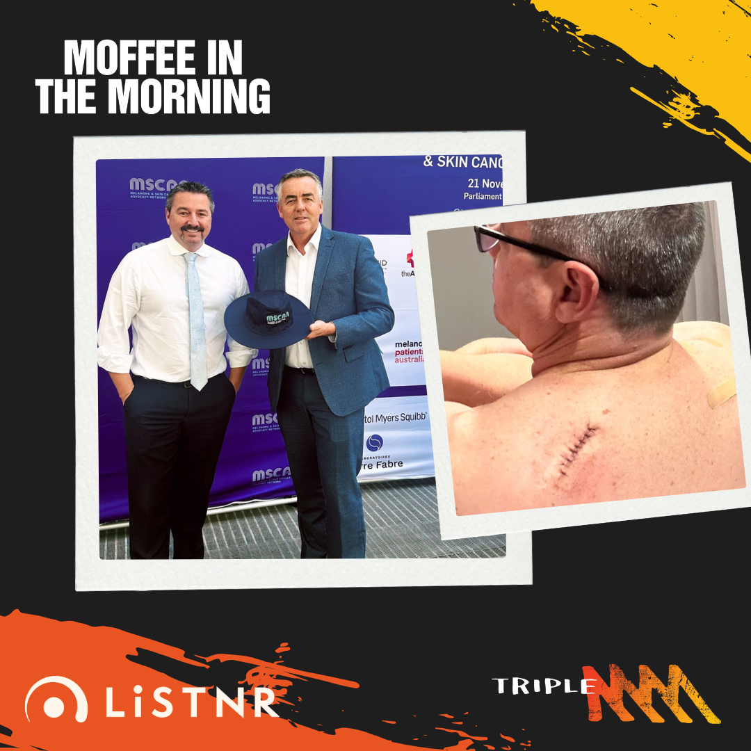 Pat Conaghan Talks About Melanoma