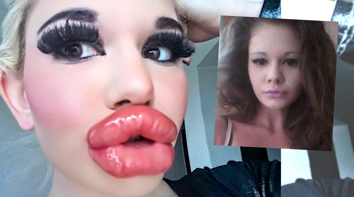 22-Year-Old With World's Biggest Lips Wants Humongous Boobs To Go With Them
