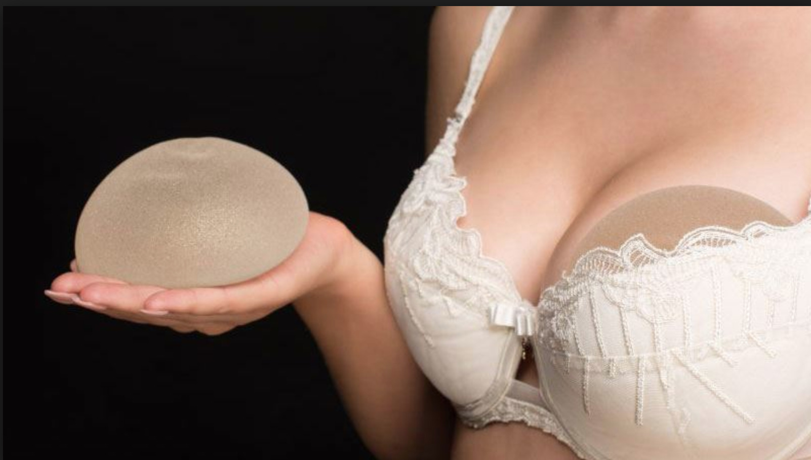 In A Divorce Who Owns Breast Implants?