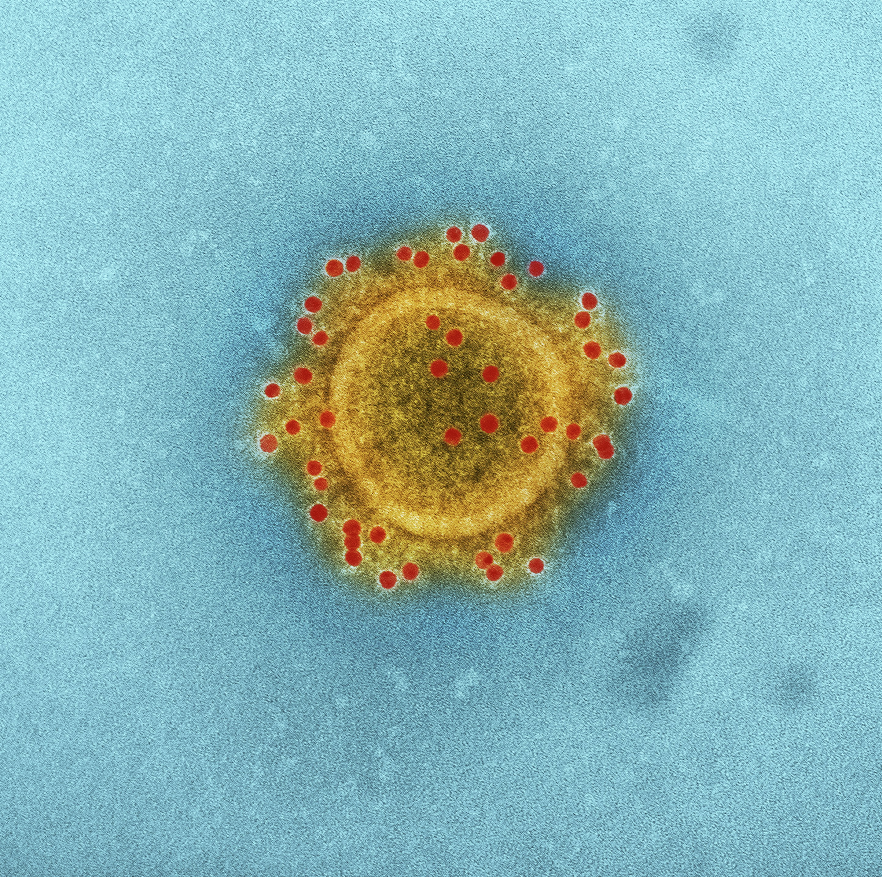 Are Melioidosis and The Bruce Highway upgrades linked?