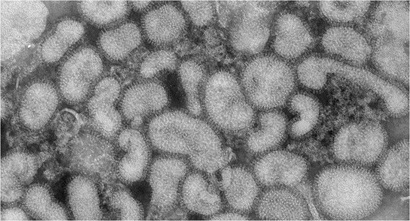 Aussies warned not to panic buy after sixth case of H5 bird flu episode artwork