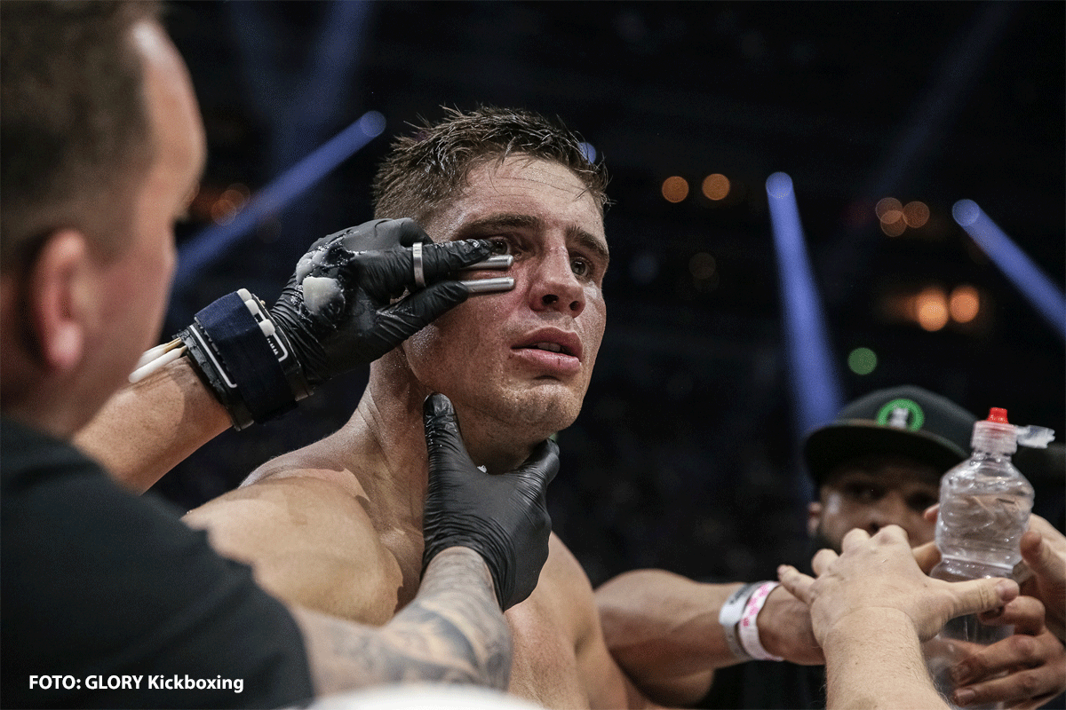 Rico moet een echte tegenstander krijgen, UFC gevechten van afgelopen nacht