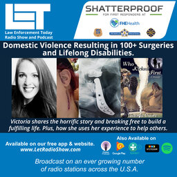Domestic Violence  Caused Lifelong Disabilities and 100 plus Surgeries