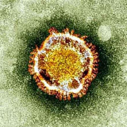 Coronavirus: What's happening in Wuhan?