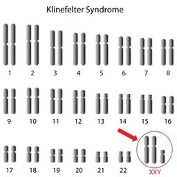Health: Klinefelter Syndrome