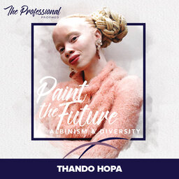 Thando Hopa: The international model redefining beauty