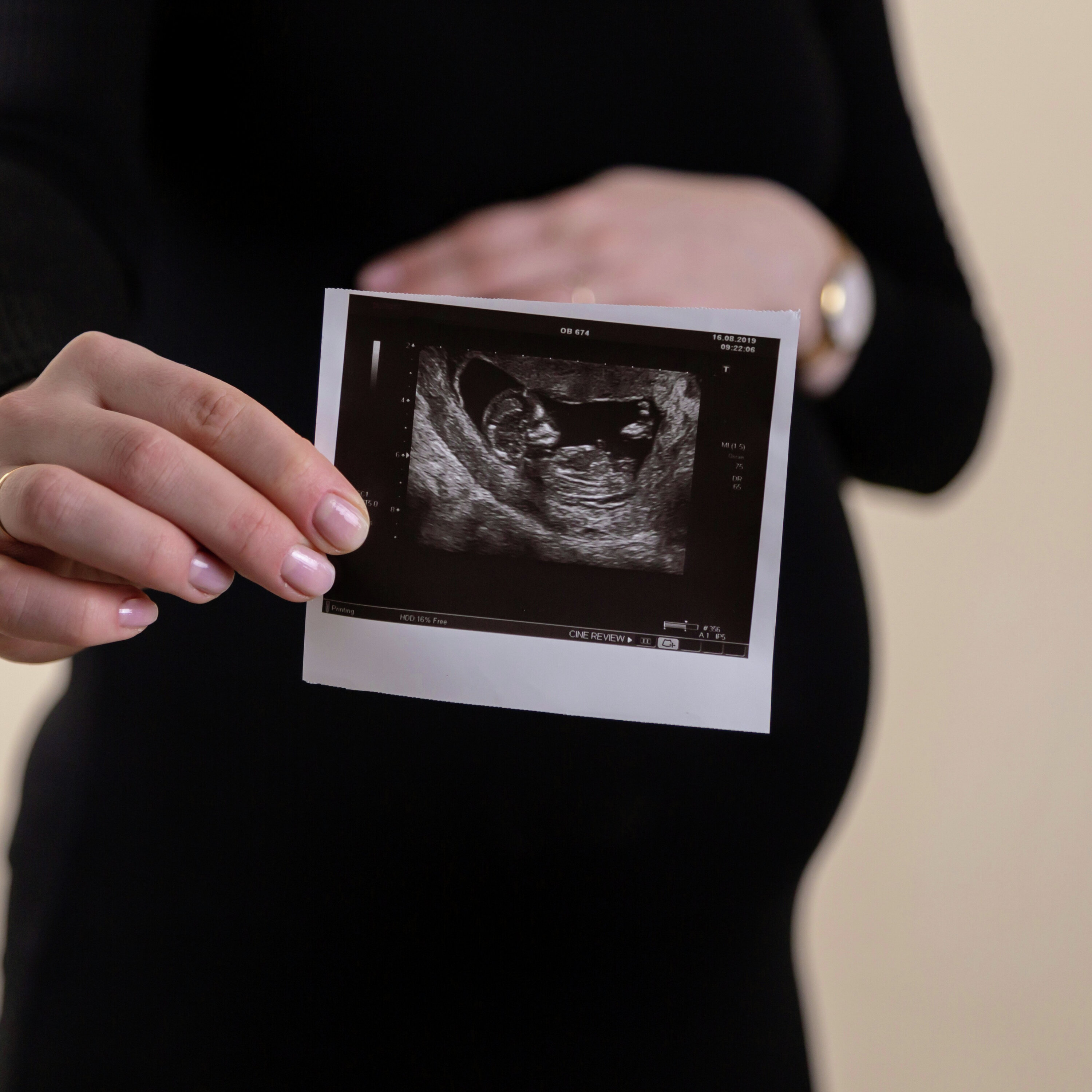 FINAL DAY PreBorn Ultrasound Campaign Sprint – We Did It! 385 Lives Touched episode artwork