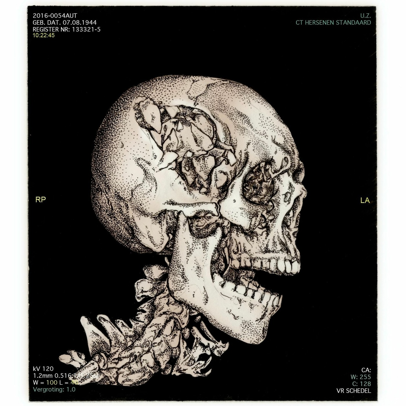 Aflevering 75 - LIVE - de pannenkoekenmoord