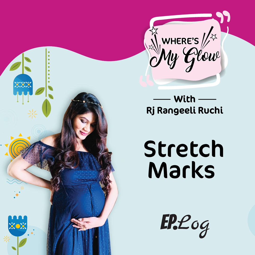 Ep 12: Stretch Marks