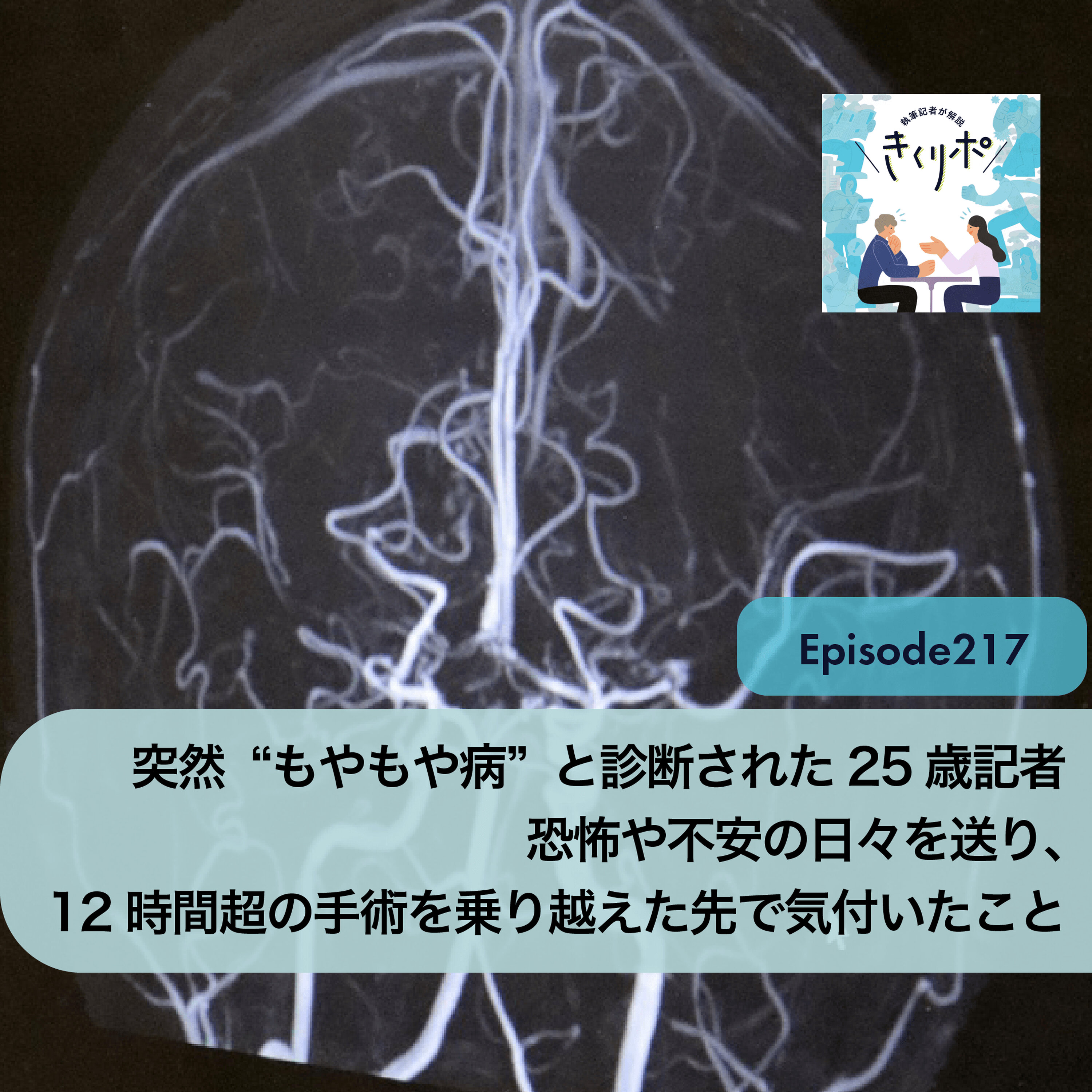 #218【きくリポ】旅行先で倒れ、突然“もやもや病”と診断された25歳の夏 恐怖や不安の日々を送り、12時間超の開頭手術を乗り越えた先で記者が気付いたこと episode artwork