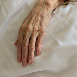 "אכזריות אמיתית": שר הרווחה כהן על בת ה-83 שהוכתה ע"י מטפלת