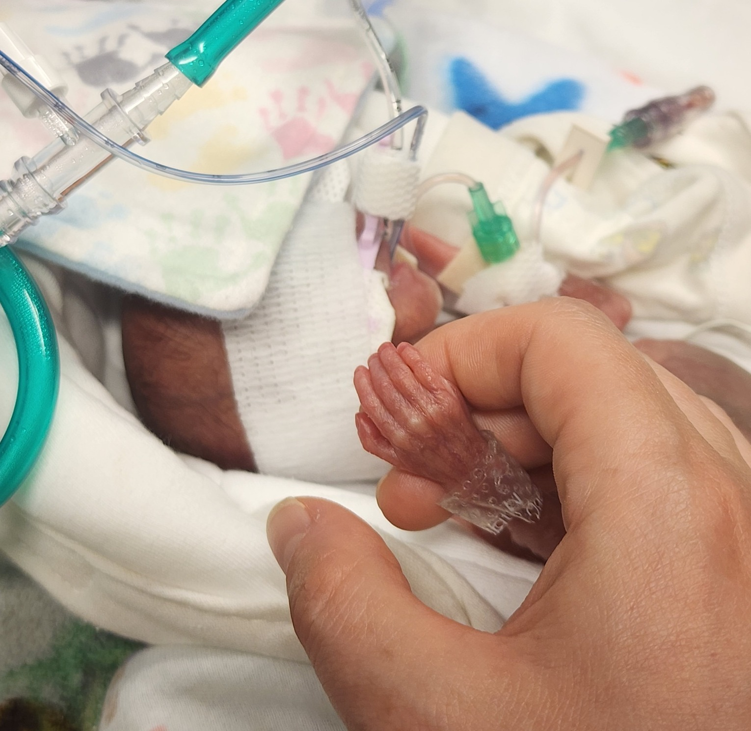 24 - Henry - The 22 Week Micro-Preemie episode artwork