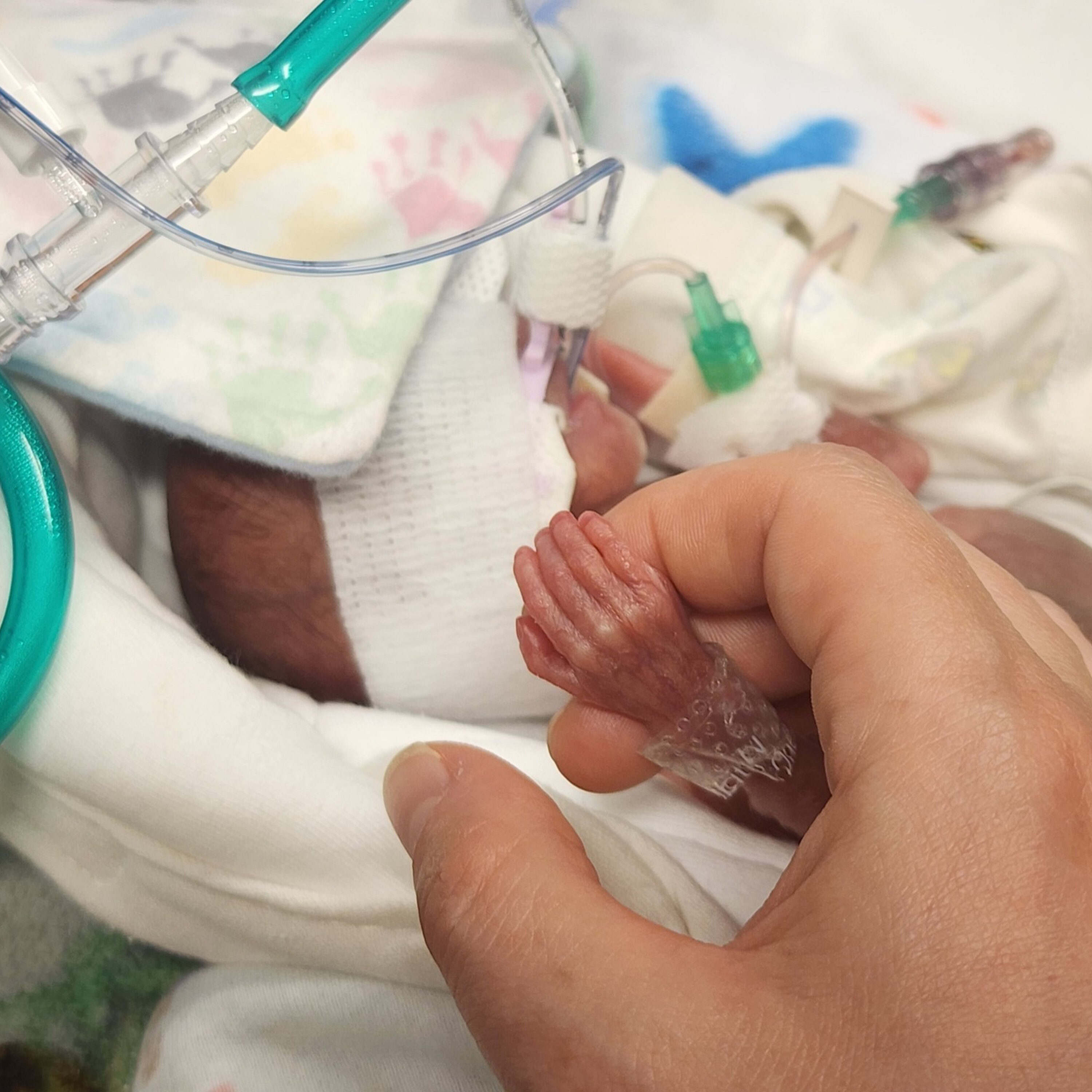 24 - Henry - The 22 Week Micro-Preemie episode artwork