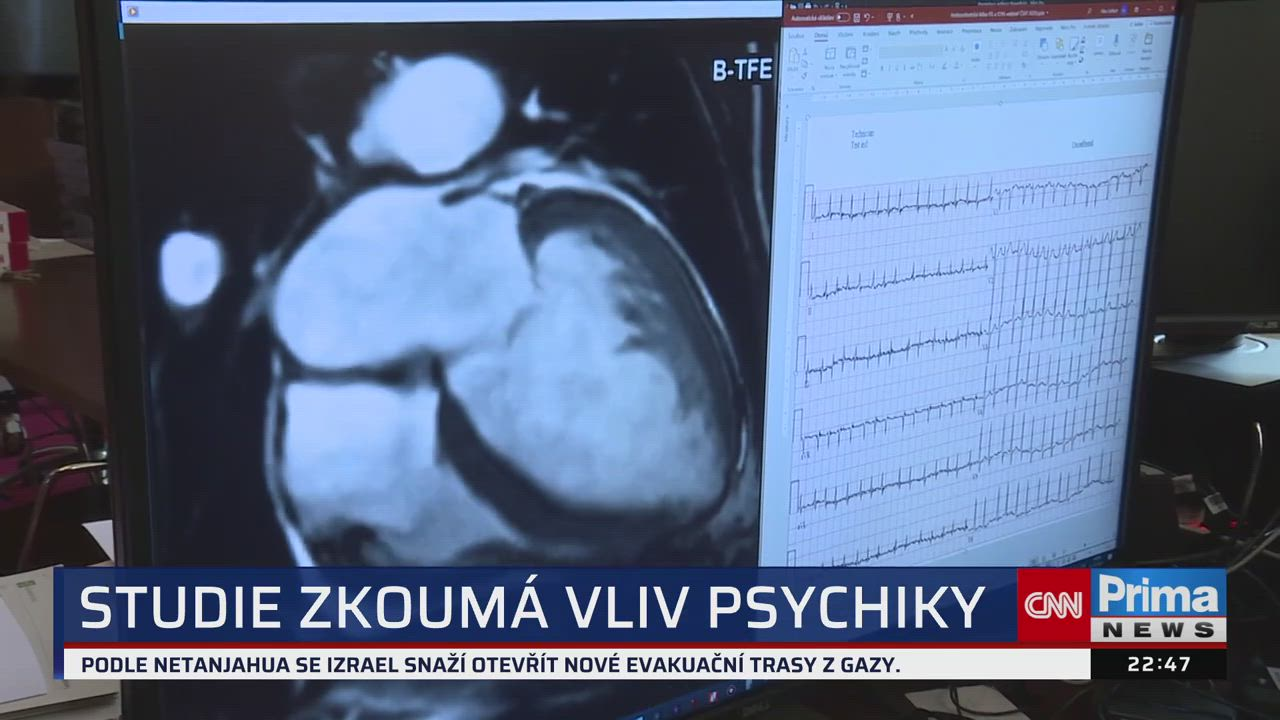 Zuperdebata mladých politiků: Bylo to směšné, všichni jsou kopie svých šéfů, míní Kolář episode artwork