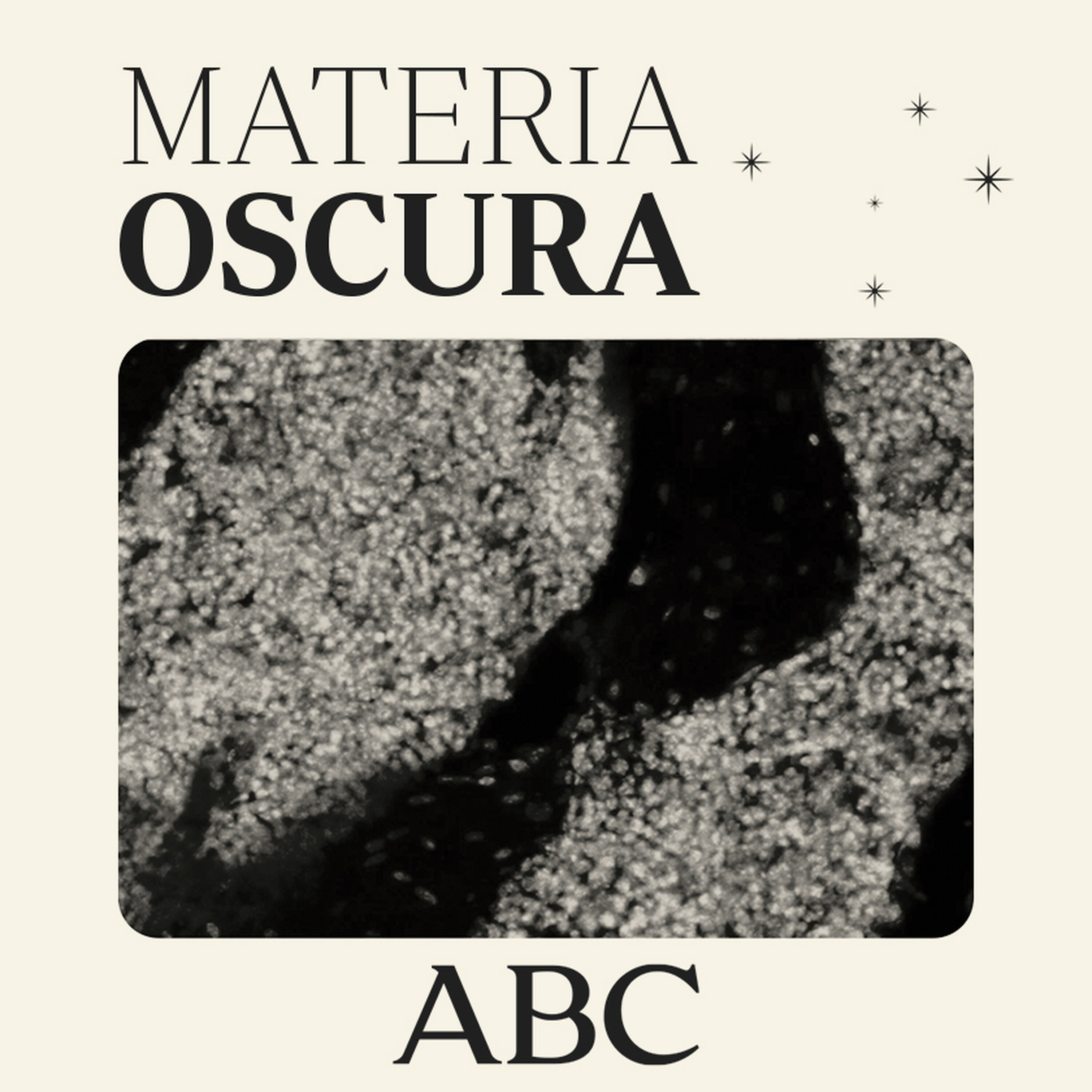 Descubren un nuevo órgano oculto en nuestro cerebro