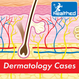 Dermatology Cases:  Vectra Mole Checks