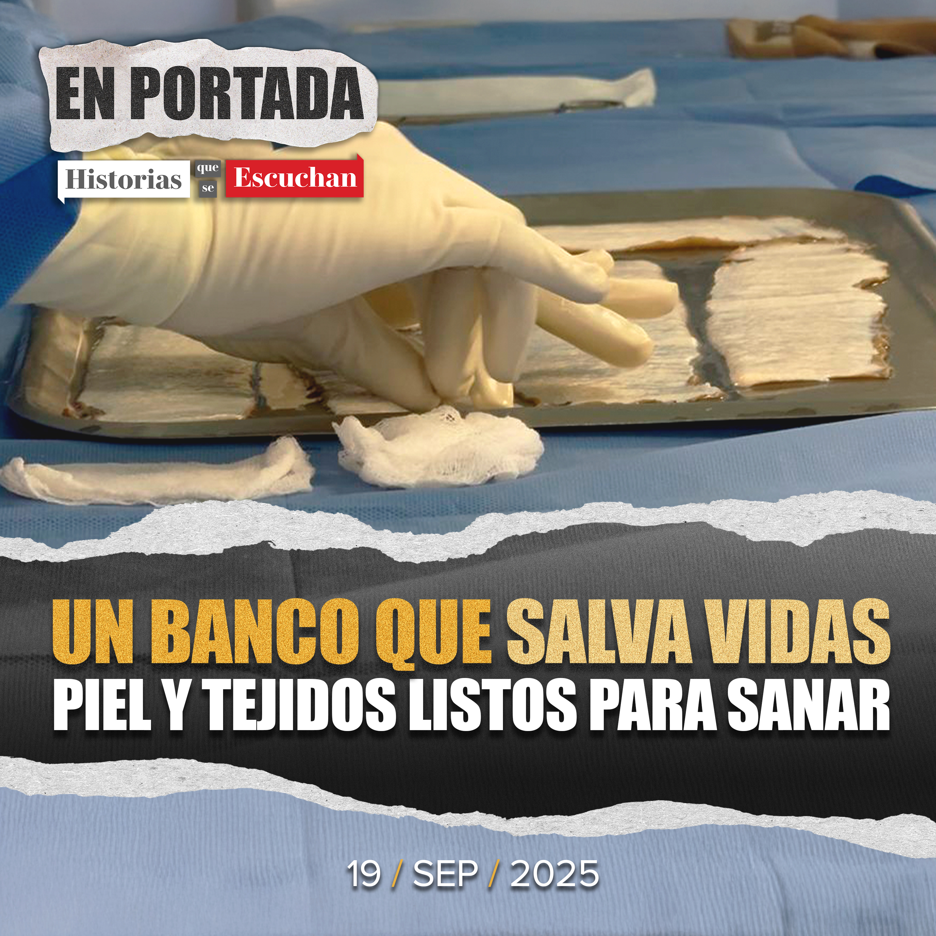 Banco de Tejidos del Edomex; listo para apoyar a víctimas de explosión en Iztapalapa