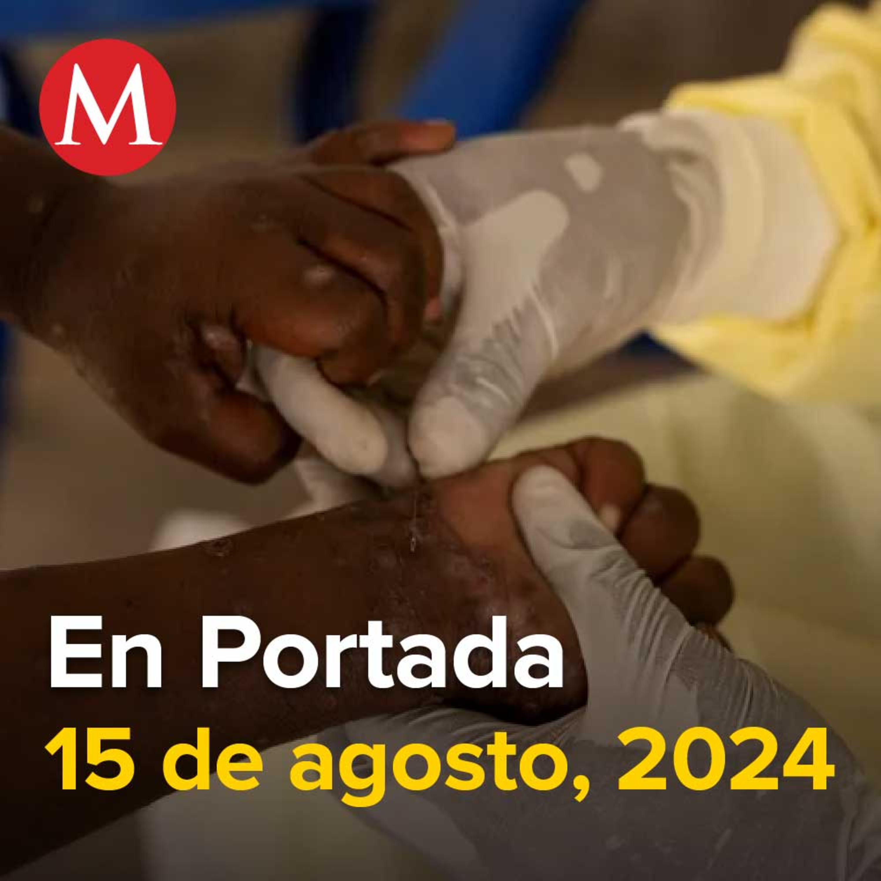 15-agosto-2024. Aviso epidemiológico por aumento de casos de mpox en África, Confirman préstamo de aeronave a Rocha para viajar a EU el día de la detención de 'El Mayo', AMLO envia carta a Biden.