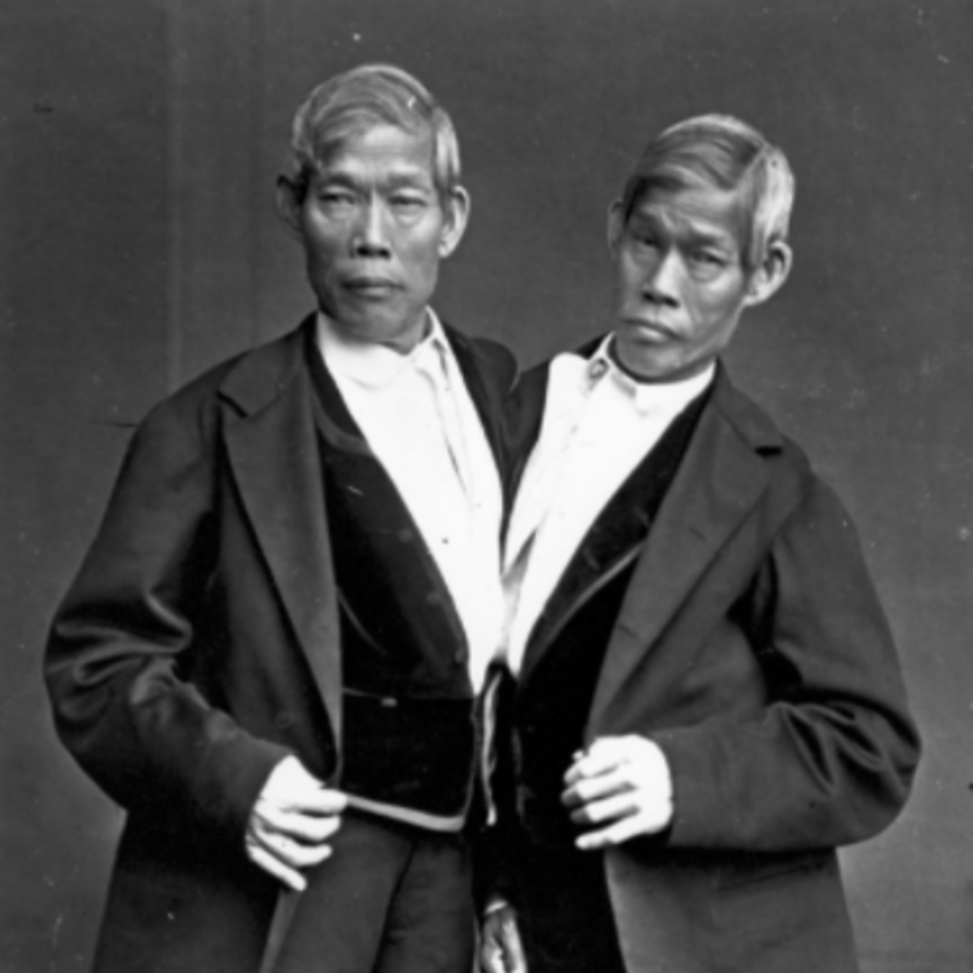 231 - The Siamese Twins - Chang and Eng