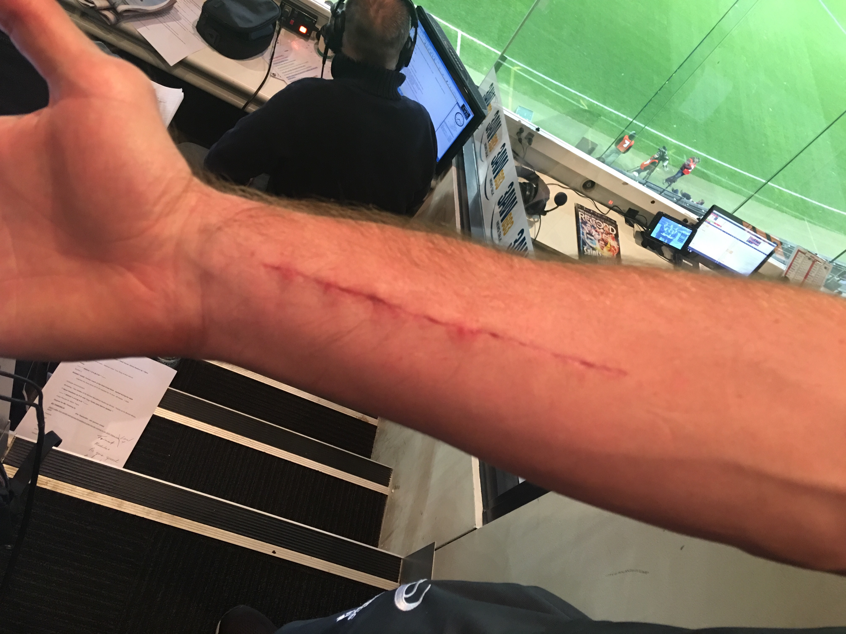 3AW's pre-match interview with injured Bulldog Dale Morris